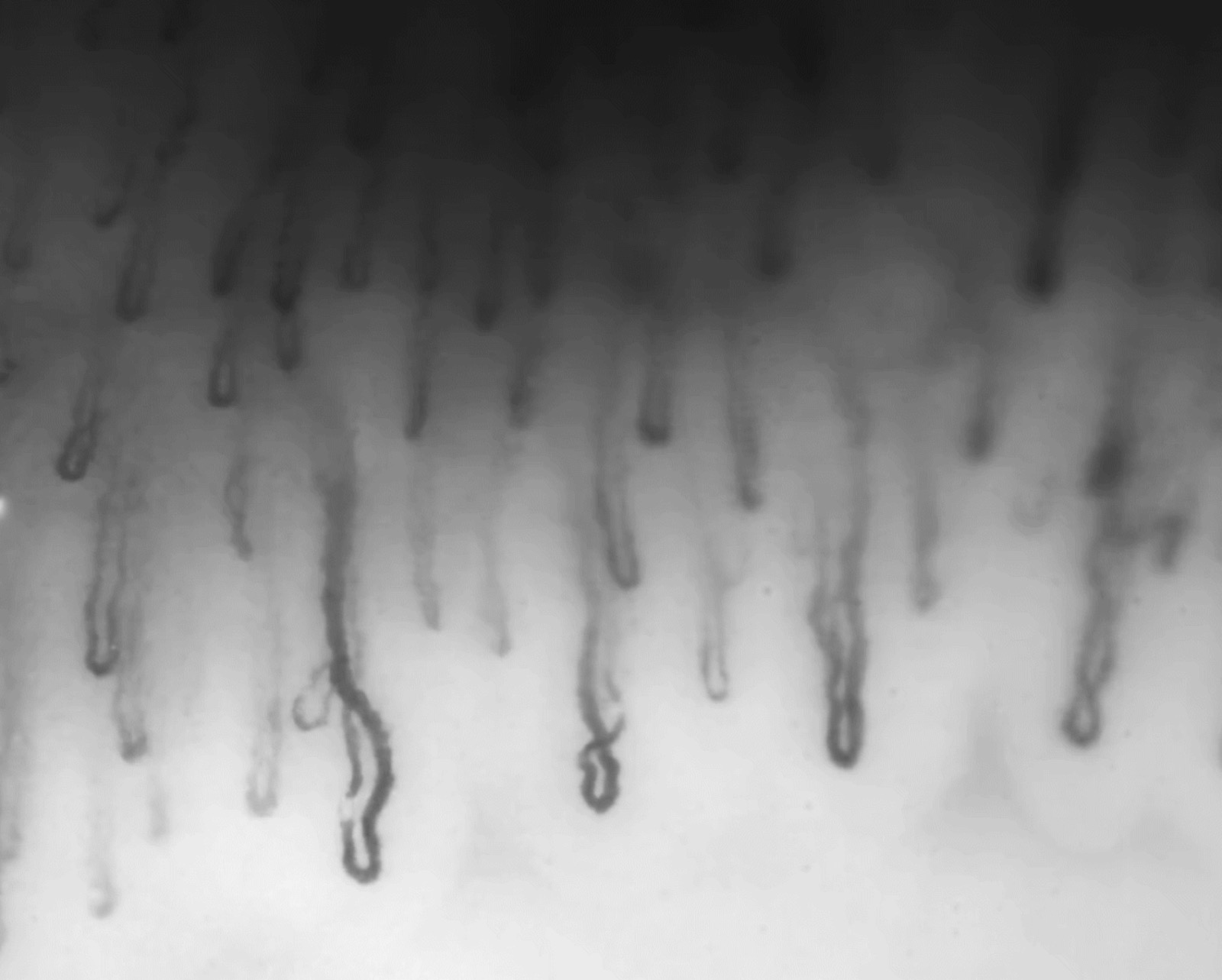 Microscopy of nailfold capillaries imaged by PointCheck™